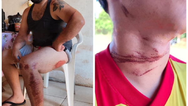 Dos accidentes causados por cables sueltos en Franco