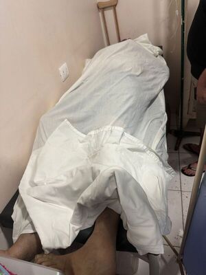 Hombre muere electrocutado cuando manipulaba forrajera