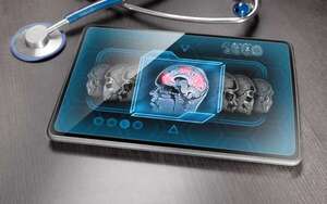 Un nuevo análisis pone en duda la exactitud de las resonancias cerebrales - Ciencia - ABC Color