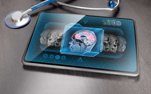 Un nuevo análisis pone en duda la exactitud de las resonancias cerebrales - Ciencia - ABC Color