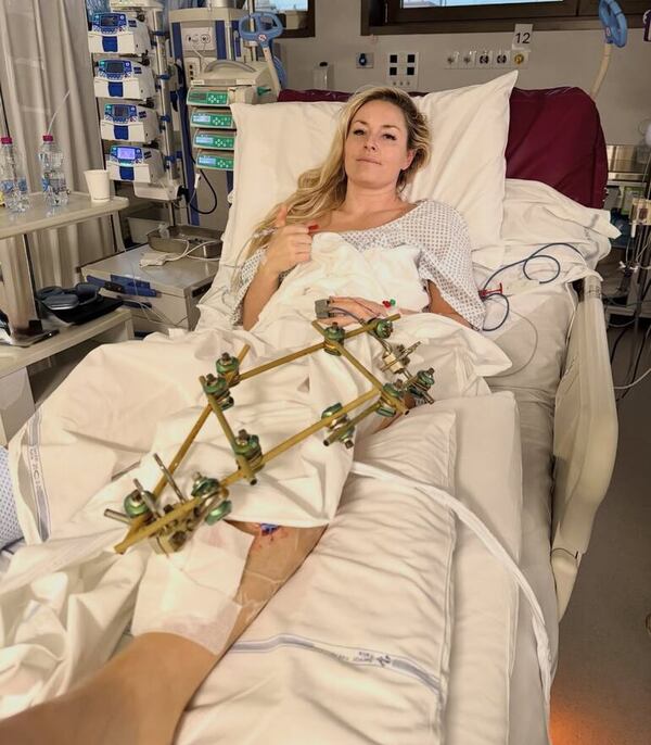 Milano-Cortina 2026: Lindsey Vonn fue operada una tercera vez de la pierna izquierda - Polideportivo - ABC Color