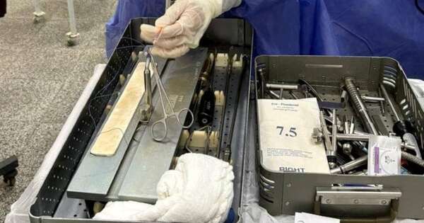 Hospitales del interior realizaron cirugías de muy alta complejidad