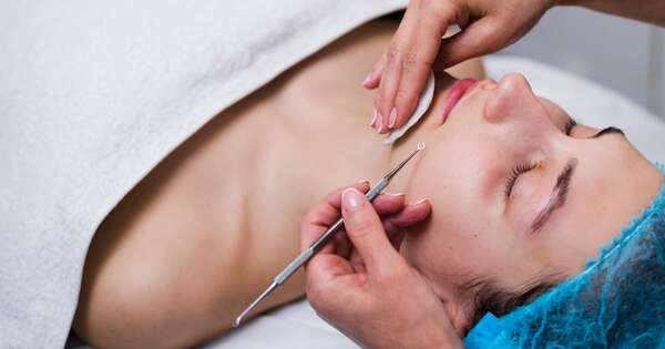 Puntos negros, causas y cuidados básicos