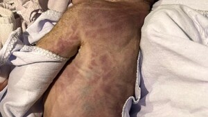 Denuncian negligencia médica tras muerte de recién nacida en Santaní