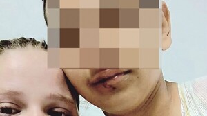 Adolescente fue héroe en accidente en Brasil