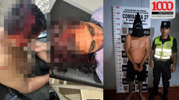 Discusión por polución sonora termina con pareja herida a machetazos en Hernandarias