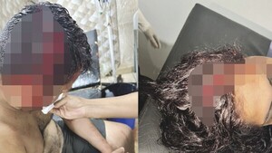 Pareja ligó machetazos por quejarse de la música