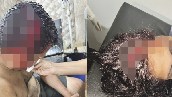 Pareja ligó machetazos por quejarse de la música