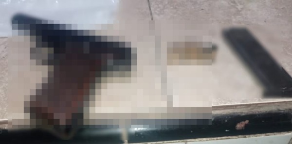 Mujer fue atacada a balazos en Encarnación