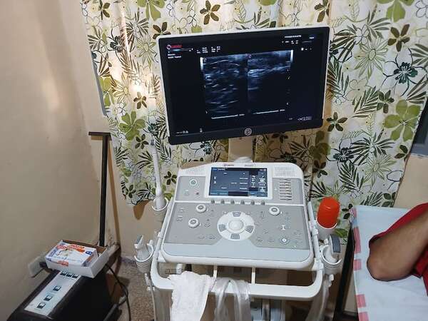 Hospital Regional de Villarrica tiene ecógrafos, pero no ecografistas los fines de semana  - Nacionales - ABC Color