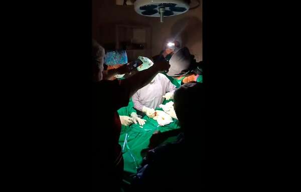 Cirugía con luz de celulares: esta es la explicación del director del Hospital de Capiatá - Nacionales - ABC Color