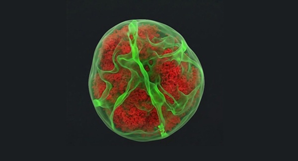 Células leucémicas mantienen "memoria mecánica" tras atravesar tejidos, según estudio internacional