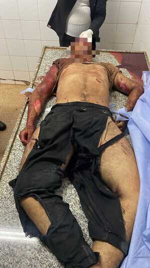 Joven motociclista fallece en accidente sobre la ruta PY07 - ADN Digital