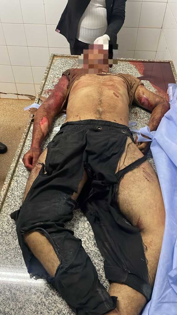 Joven motociclista fallece en accidente sobre la ruta PY07 - ADN Digital