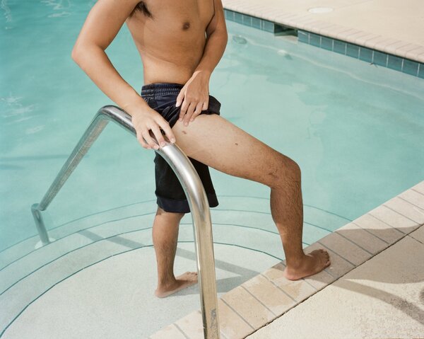 La cirugía de aumento de estatura puede agregar centímetros, pero tiene riesgos