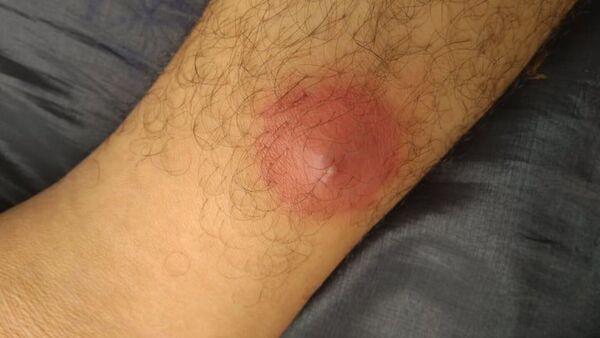 ¿Dónde aparece el susu’a? Estas son las zonas más comunes