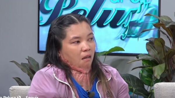 Le explotó la garrafa y necesita cirugía: “Mamá, vos no parecés un monstruo”