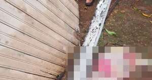 Diario HOY | Hombre muere tras caída de un portón sobre su cabeza