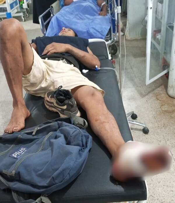 Luque: balean a joven en plena vía pública y autor se da a la fuga - Policiales - ABC Color