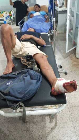 Popular / Ojejapi a un karia’y, a escopetazo