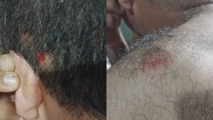 Atacó a pedradas al vecino por pedirle que limpie su vereda