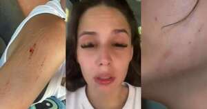 Diario HOY | Joven denuncia a su primo policía por agredirla, en medio de un conflicto familiar