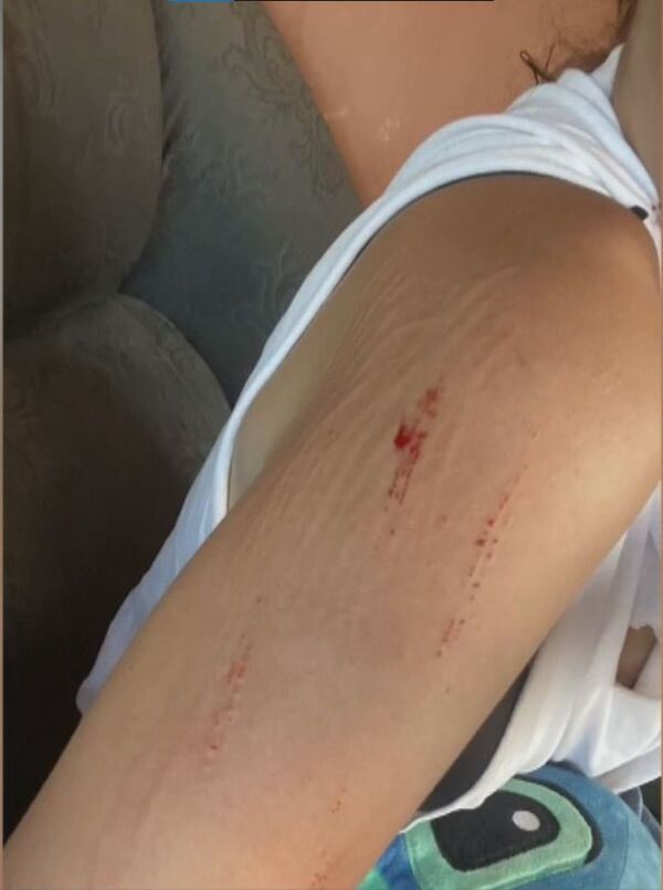 Mujer acusa a su primo policía de agresión por disputa vecinal