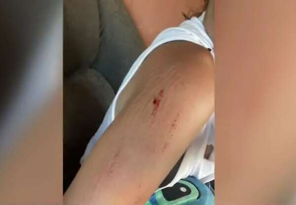 Joven denuncia agresión en disputa por terreno dentro de la Chacarita - Policiales - ABC Color