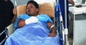 Máquina tritura la mano de un operador de empresa Hambre Cero •