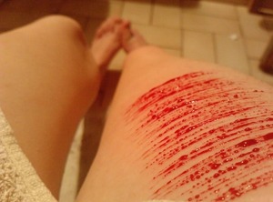 Más de la mitad de los adolescentes conoce a alguien que se ha autolesionado en algún momento de su vida