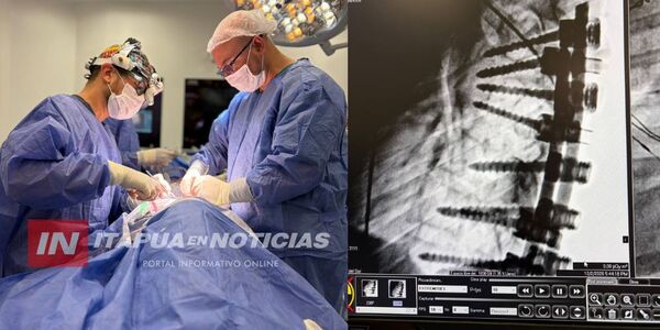 EL HGI CORRIGE COMPLEJA MALFORMACIÓN CONGÉNITA DE COLUMNA EN UNA NIÑA