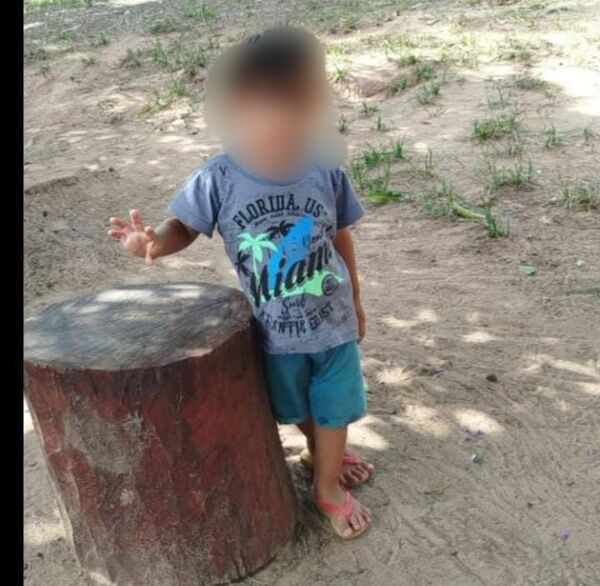 Tragedia en Loreto: niño de 2 años muere tras recibir descarga eléctrica - Concepción al Día