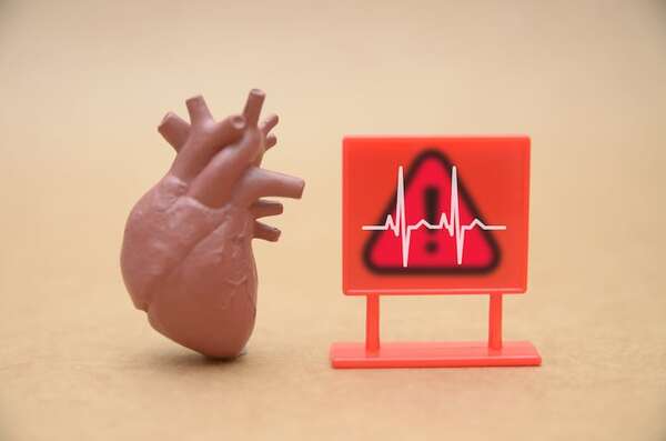 ¿Es seguro mantener una vida sexual activa después de un infarto? - Sexualidad - ABC Color