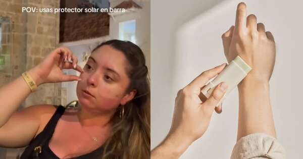 La Nación / “Me creí aborigen”: paraguaya quedó con quemadura en bloque y se viralizó