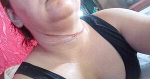 Diario HOY | Mujer casi fue degollada por un cable suelto en pleno centro de Asunción