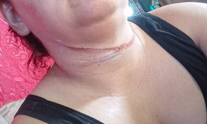 Mujer sufre graves cortes en el cuello por cable suelto en pleno centro de Asunción - OviedoPress