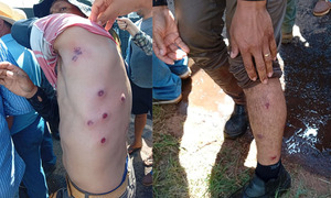 Cañicultores inician movilización en Troche y denuncian represión del gobierno con balines de gomas - OviedoPress