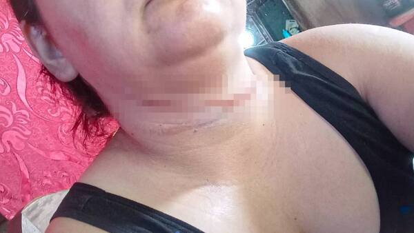 Cable colgado se le enredó por el cuello y casi ocurrió una tragedia