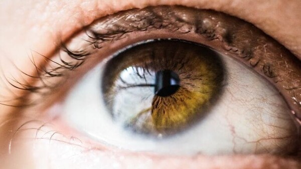 Más de 130.000 paraguayos viven con glaucoma sin saberlo