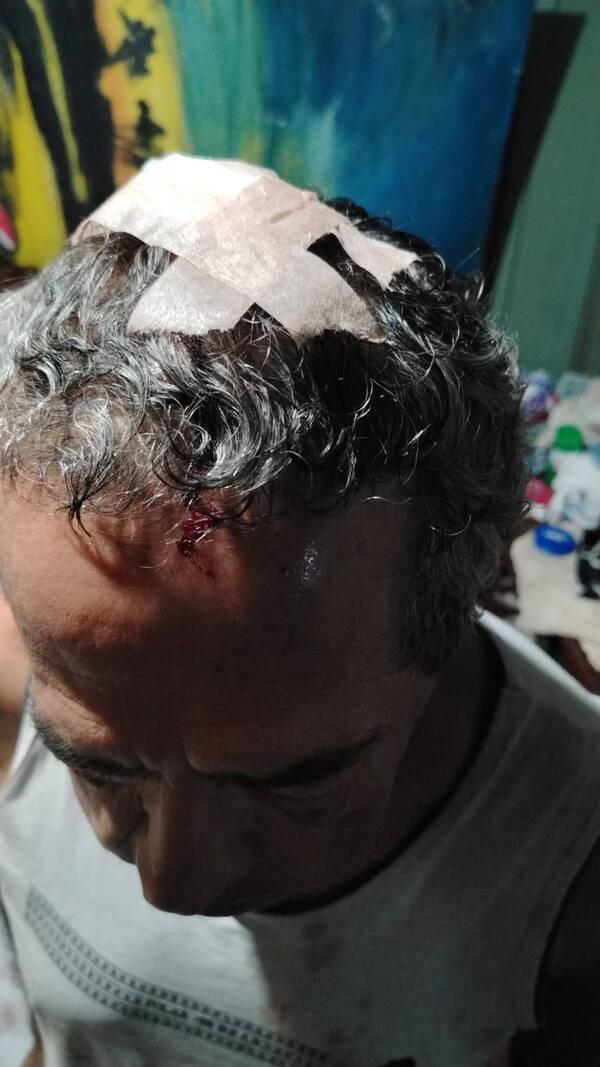 Popular / Motochorros oñakâjoka a locutor en asalto domiciliario