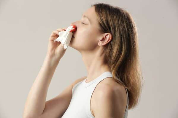 Sangrado nasal: causas reales y errores que empeoran la situación - Ciencia - ABC Color