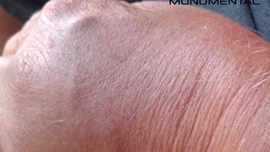 "El abuelo no se va morir por una muñeca rota", le dijo una doctora