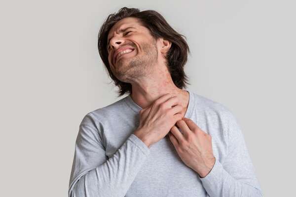 Estudio revela cómo el estrés agrava la dermatitis: informate aquí - Ciencia - ABC Color