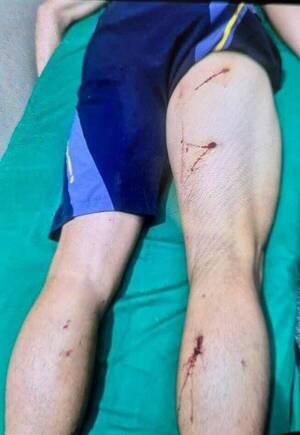 Volvieron los chancholigans; atacaron al plantel del Kure