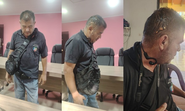 Comunicador denunció que lo agredieron para evitar que entre a sesión de la Junta en Repatriación - OviedoPress