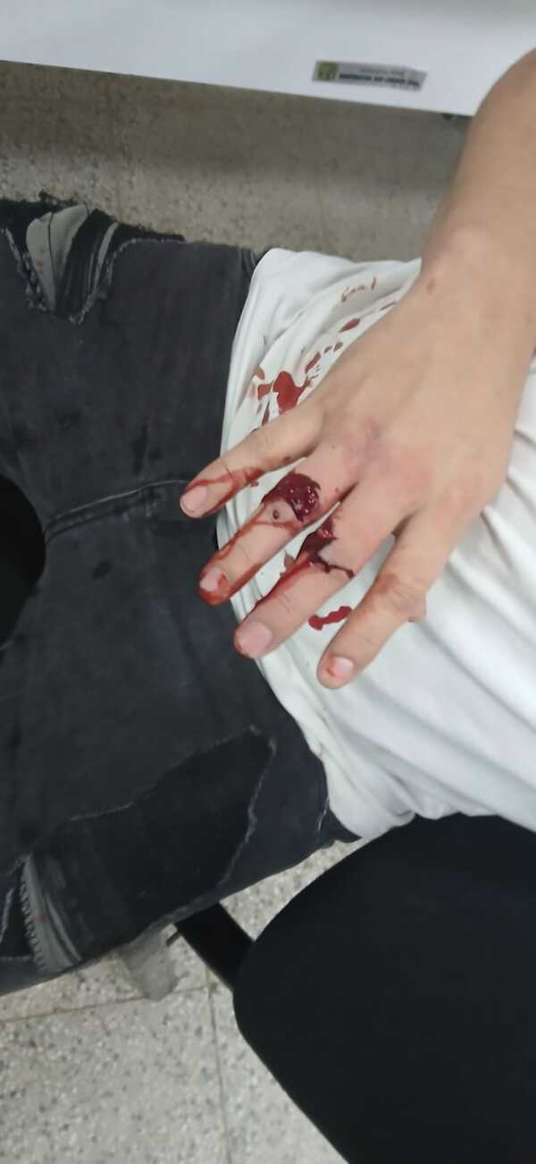 Popular / Balean a joven en la mano tras ataque a tiros