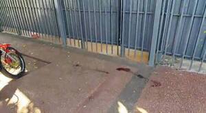 Asalto a distribuidora: se llevan fármacos adelgazantes y hieren a guardia