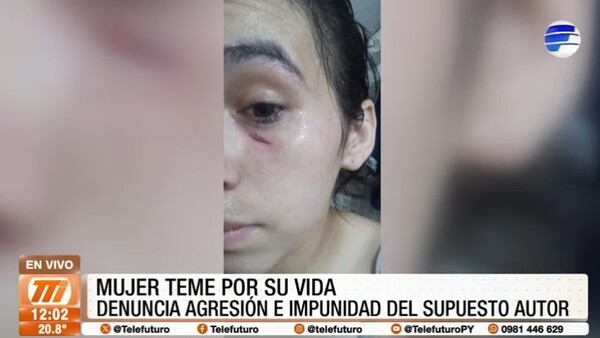 Joven denuncia brutal ataque de su ex y teme por su vida