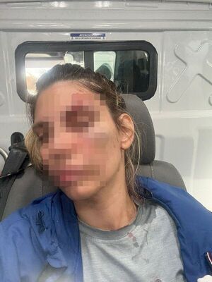 Popular / Mujer denunció a su expareja por violencia y amenazas