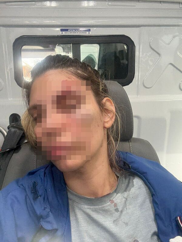 Popular / Mujer denunció a su expareja por violencia y amenazas